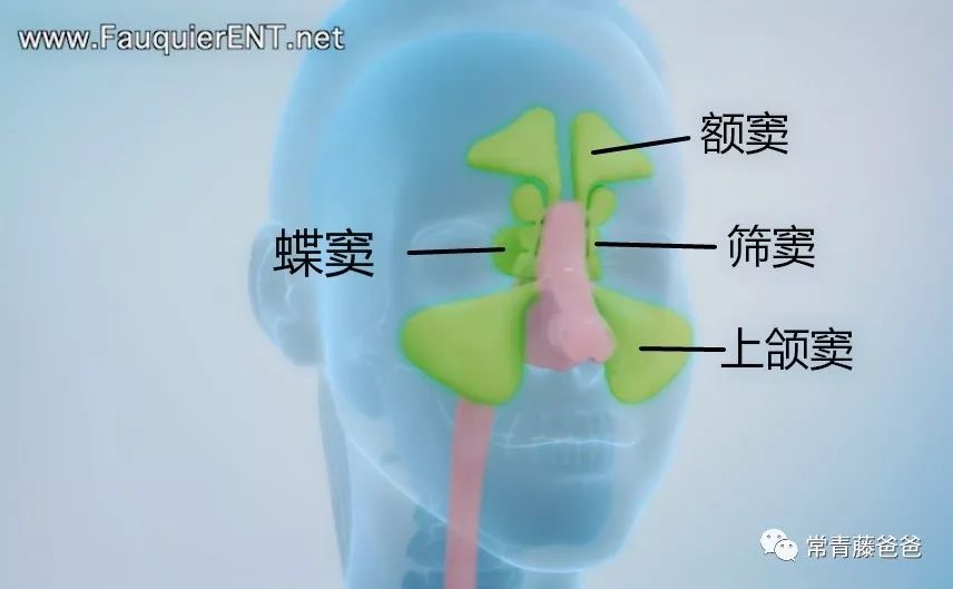 那什么又是鼻窦炎呢?