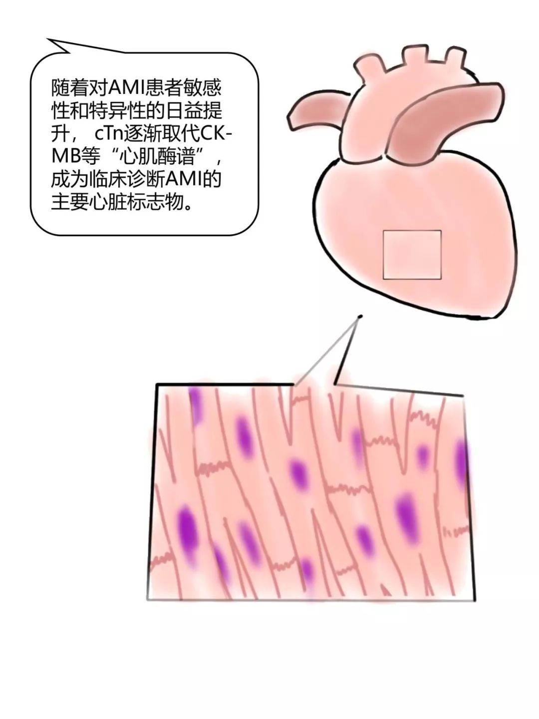 心机损伤标志物图片