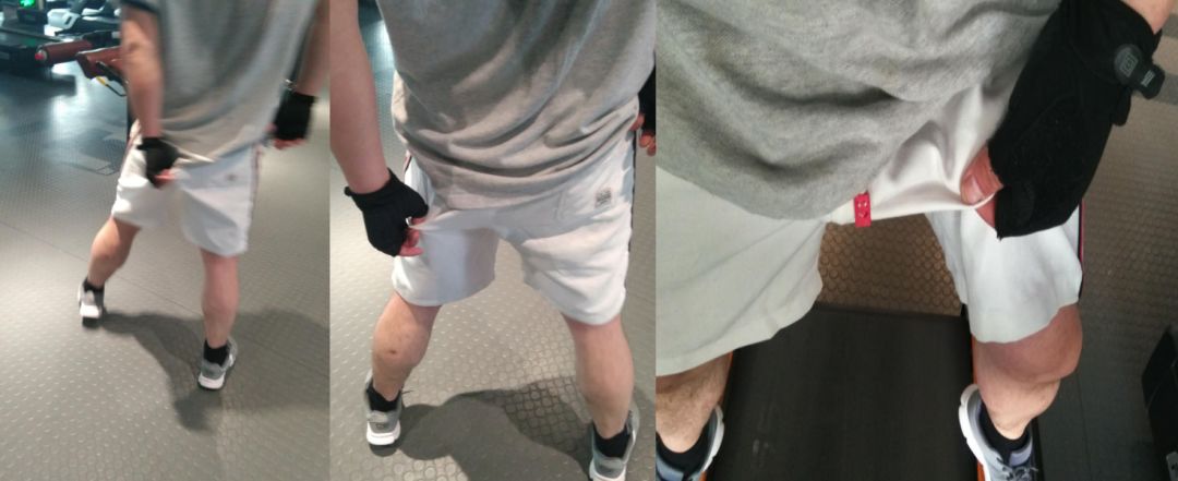 跑步最怕磨裆部马拉松比赛经常出血到底怎么回事