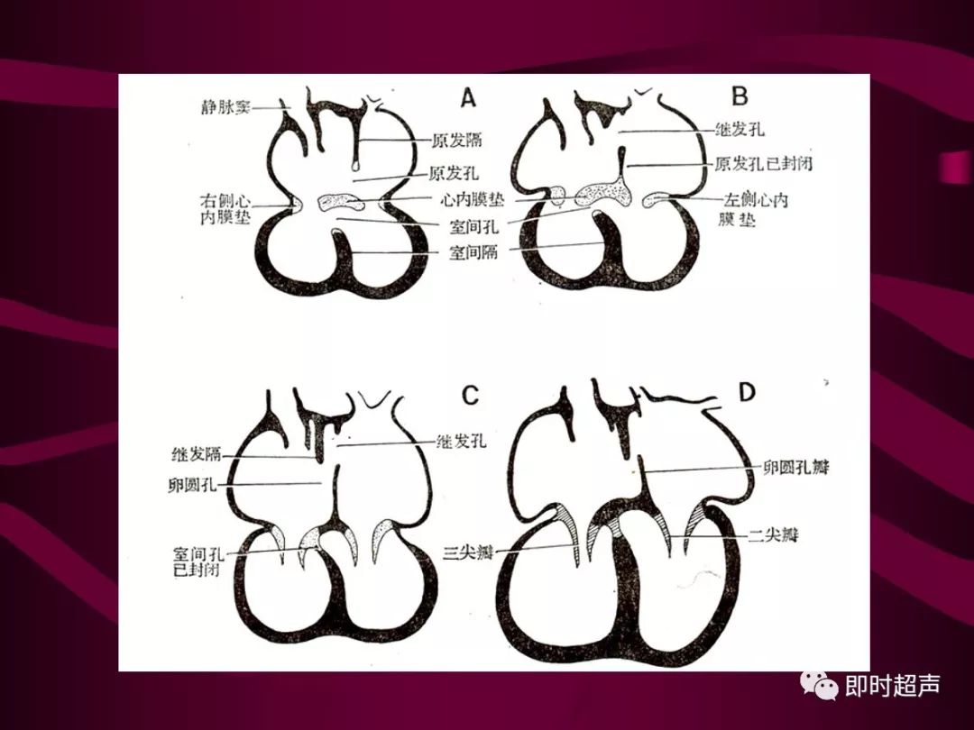 先天性心脏病的超声诊断