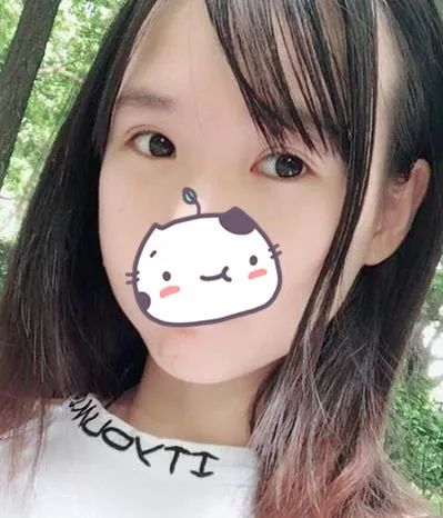 窄了不明显宽了太夸张双眼皮割多宽才好看
