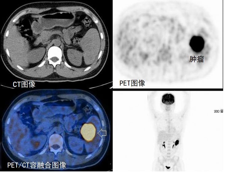 为何拍了X光片,还要做CT甚至磁共振,它们的辐射有多大?-搜狐大视野-搜狐新闻