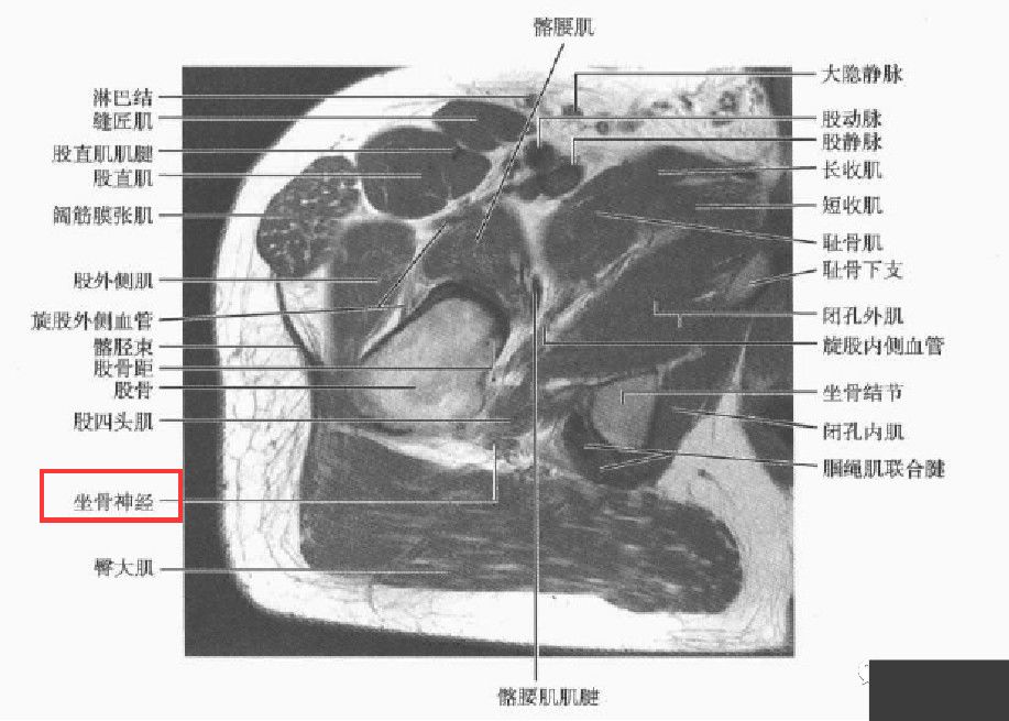 梨状肌断层解剖图图片