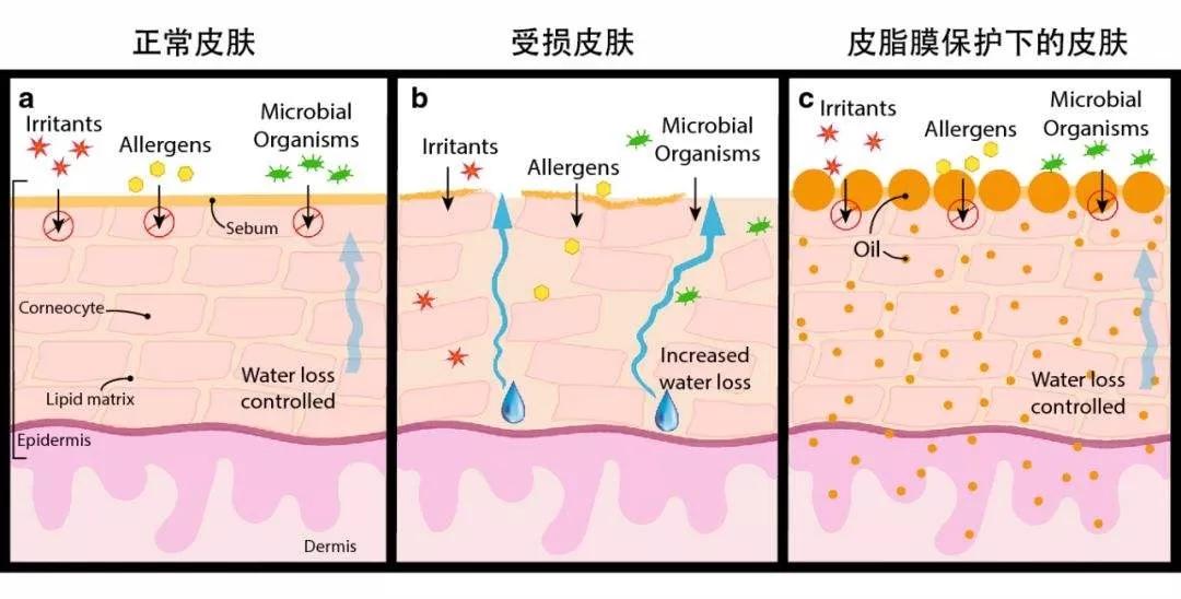 夏沫護膚老師:關於皮脂膜,你瞭解多少?