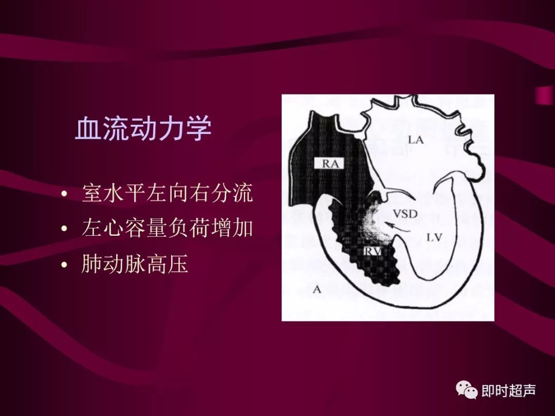 先天性心脏病的超声诊断