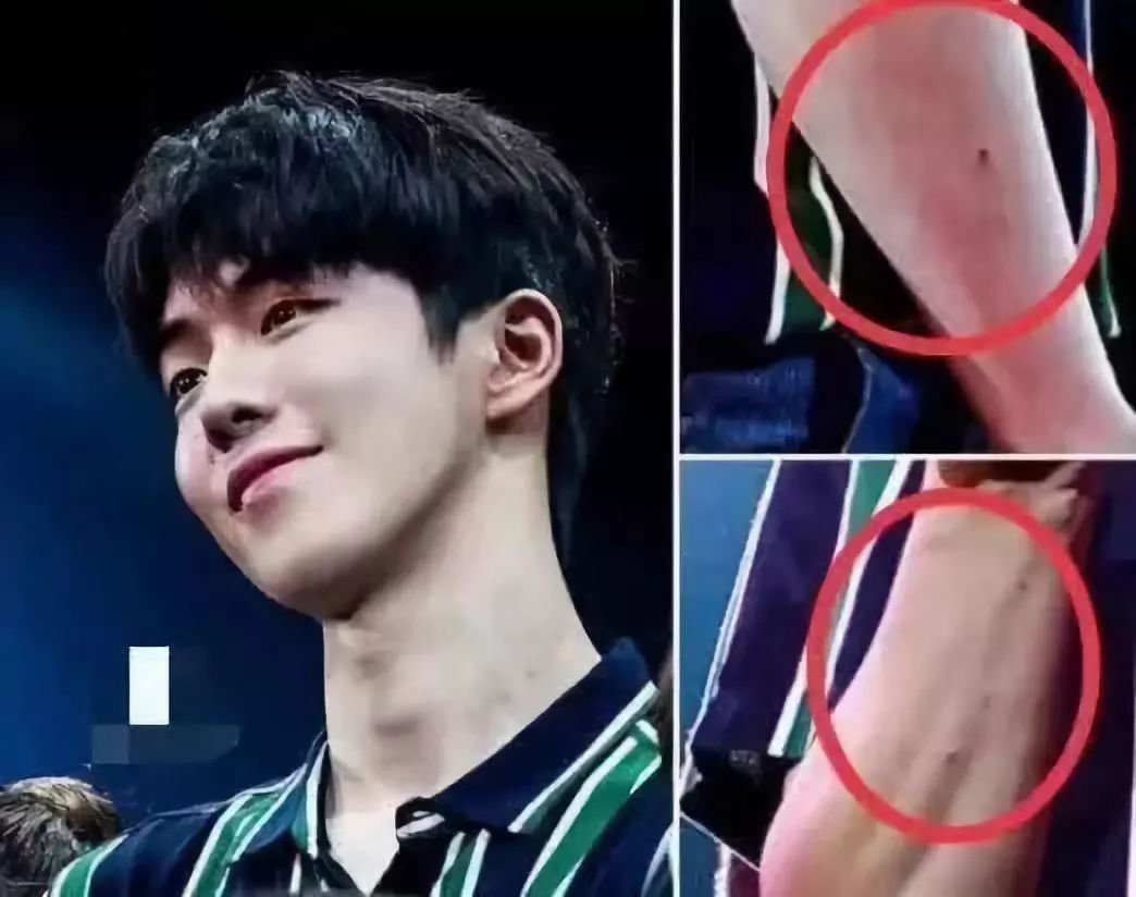 见面结束后,南柱赫被拍到胳膊上伤痕累累,而这些伤痕的制造者正是爱他