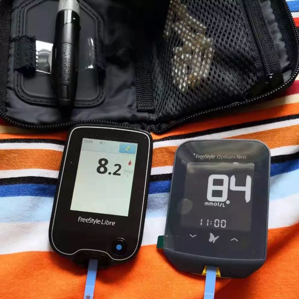 雅培动态血糖仪准不准