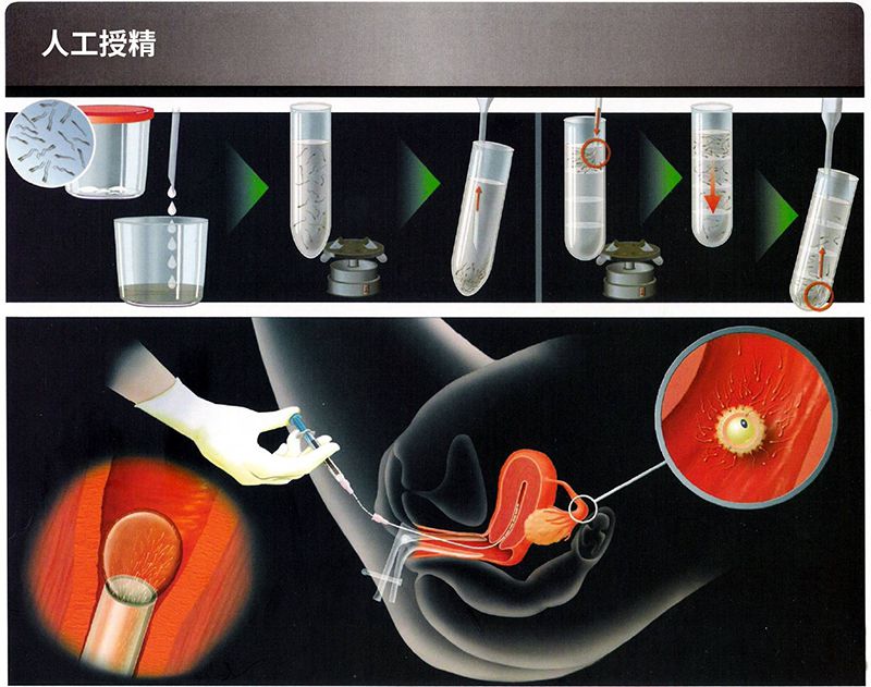 人工检查 男性图片