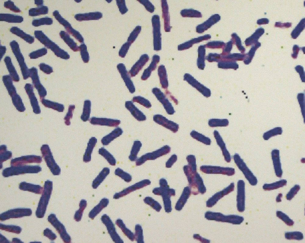 【第三十九讲】李斯特菌:吃出来的脑膜炎_治疗