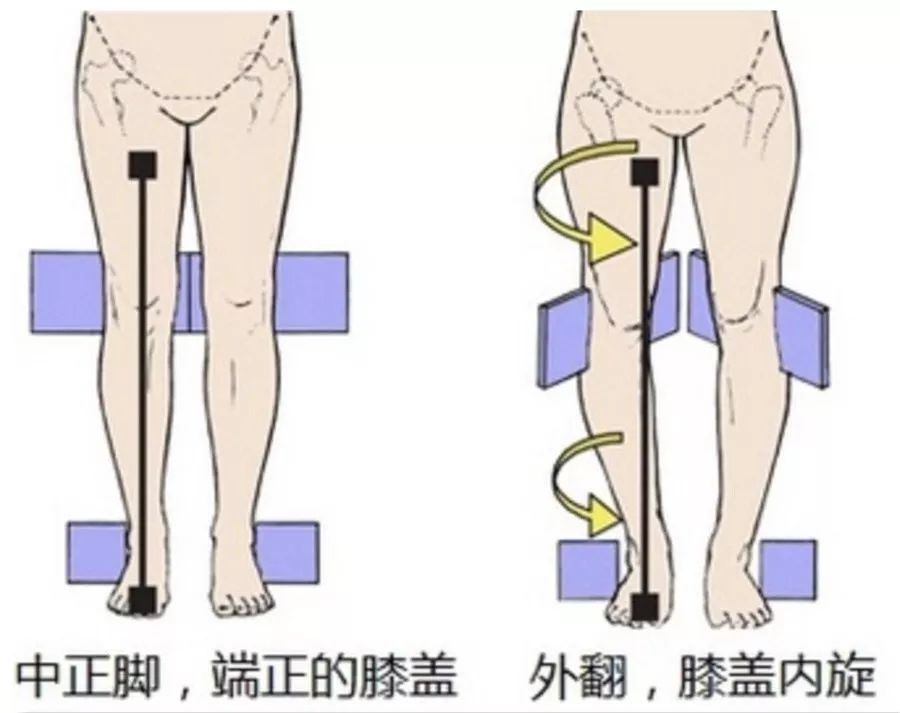 姐妹们说过,不仅是xo形腿的原因,也会让 大腿过度内旋从而造成假胯宽