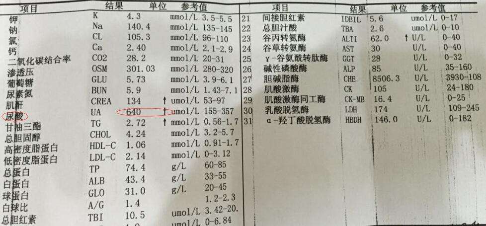高尿酸多是3物2水导致多做3件事尿酸嗖嗖降到280