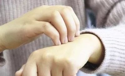 怎样减轻牛皮癣症状 f05a9e7f461c4793b4357325249620fb.jpeg