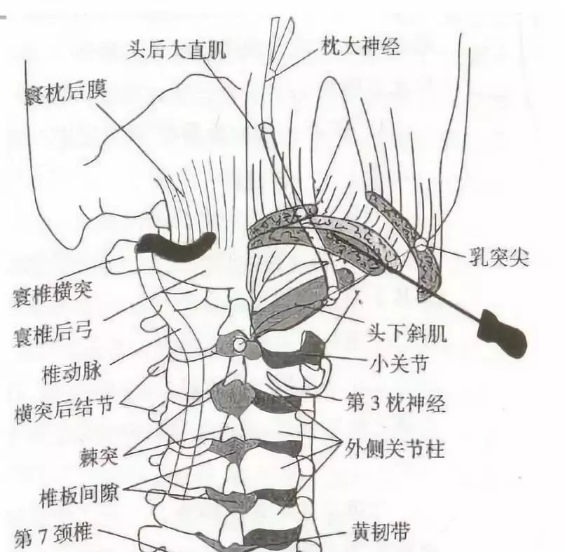 颈椎神经根分布图图片