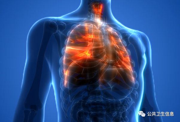 四氢大麻酚产品可能在电子烟使用或吸电子烟引起的肺损伤暴发中发挥