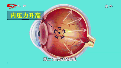 400_225gif 动态图 动图