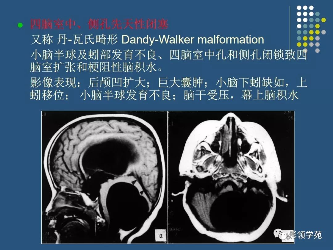 颅脑畸形军检图片