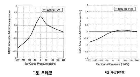 鼓室图正常值A型图片