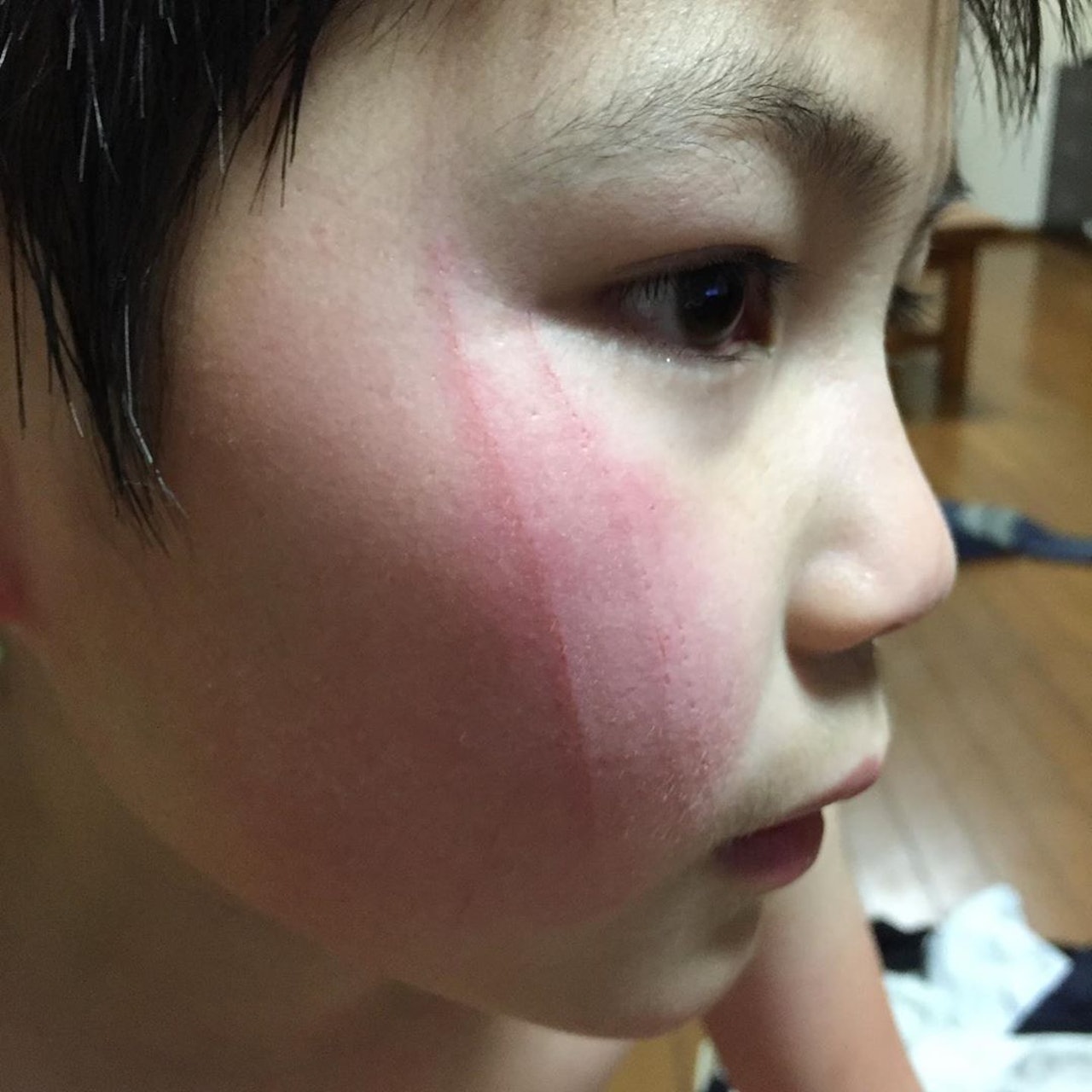 小主人被猫咪抓伤脸竟然自制防抓神器安心撸猫