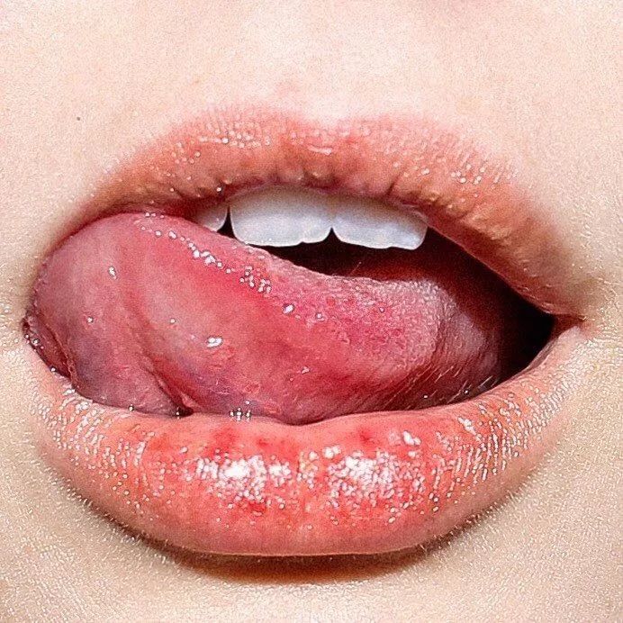咬舌根把舌头完全伸出口腔,用上门牙或者侧牙咬舌头根部