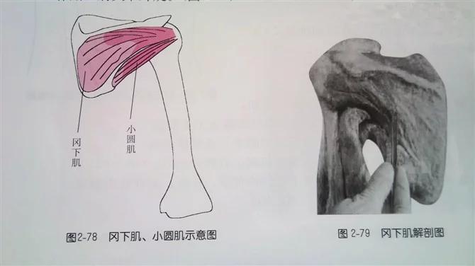 小圆肌痛图片