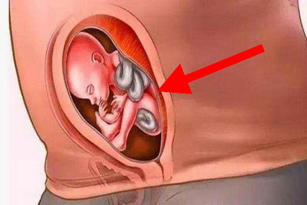 怀孕后子宫变化图片