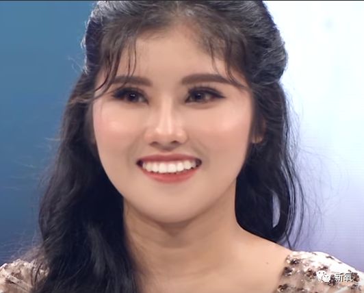 大饼脸,眯眯眼的她,在全脸每一块骨头都重新组合后变成这样了