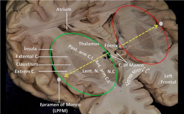 按照象限划分法将中央核进一步分为前下,前下,后上和后下四个象限