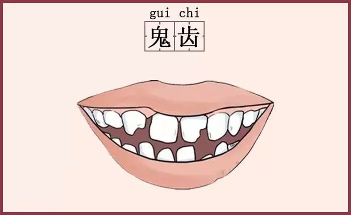 鬼齿02有这样齿相的人,婚姻方面都能找到适合自己的另一半,嫁贵夫,入