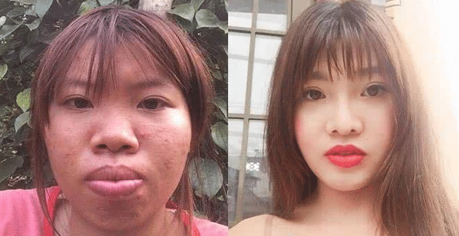丑女孩花九万整容后嫁给富二代 后来摔了一跤"原形毕露"