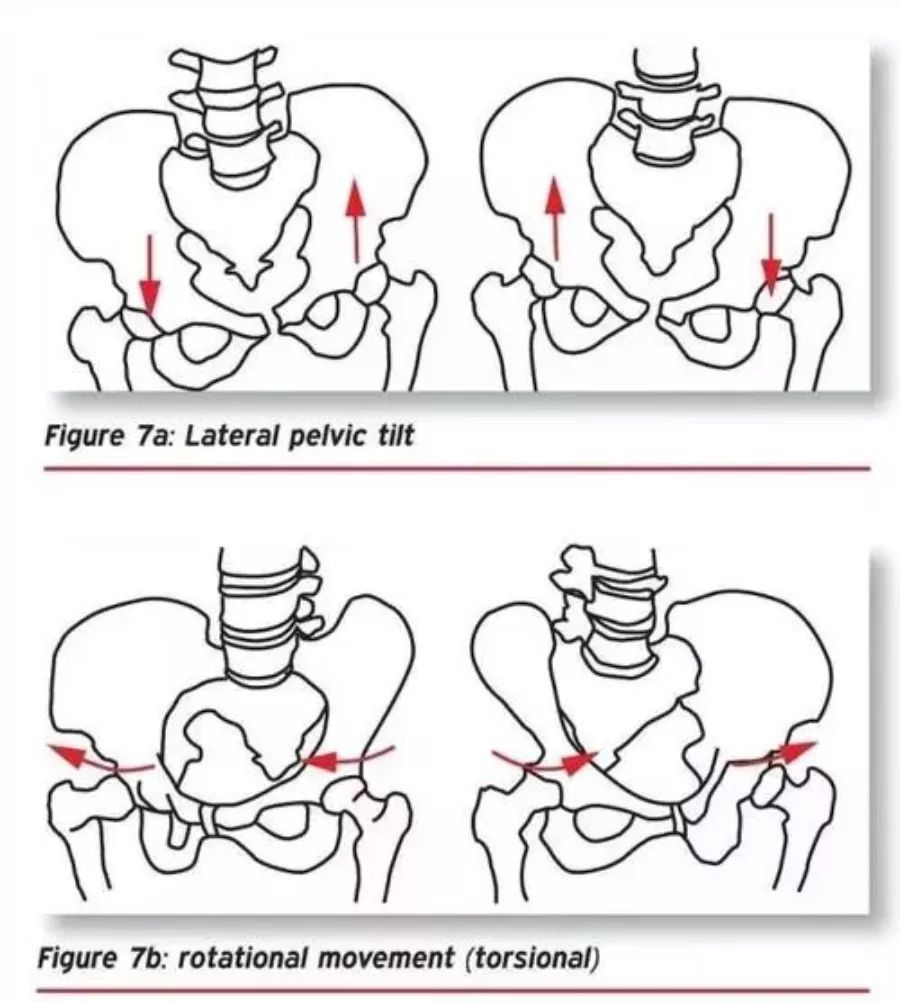 torsional strain图片