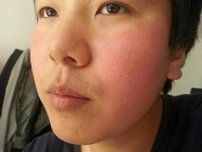 精妆联华面部角质层的修复方法你知道吗