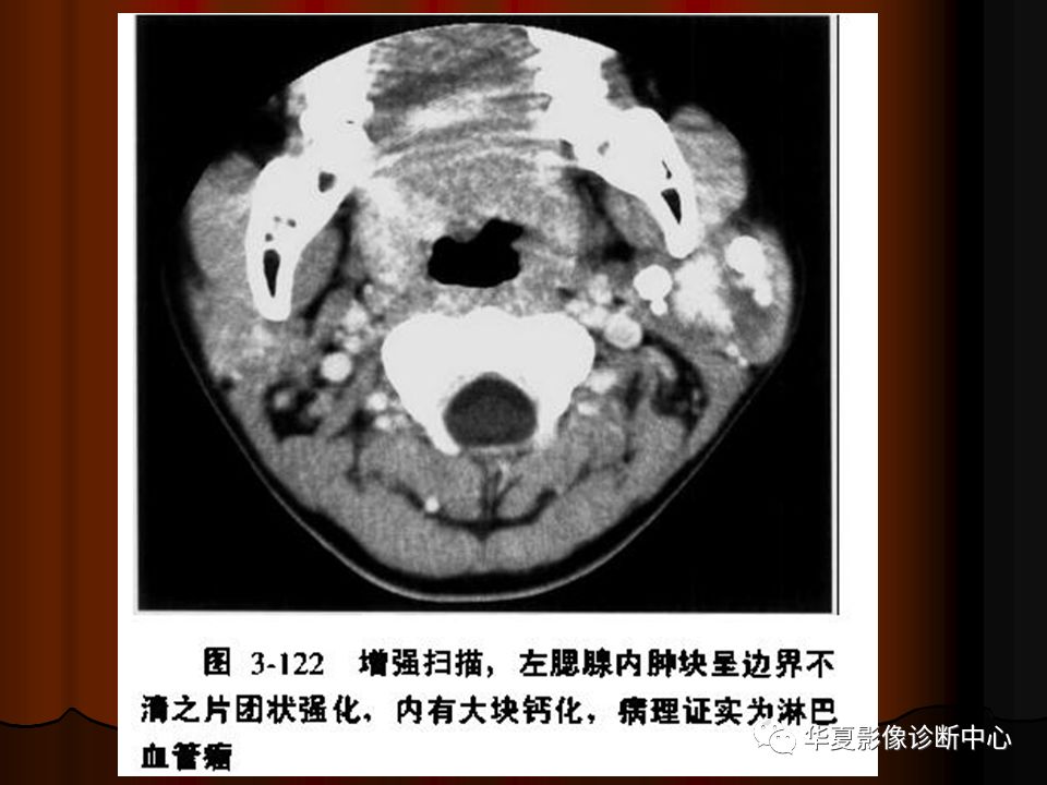 口腔颌面部ct诊断