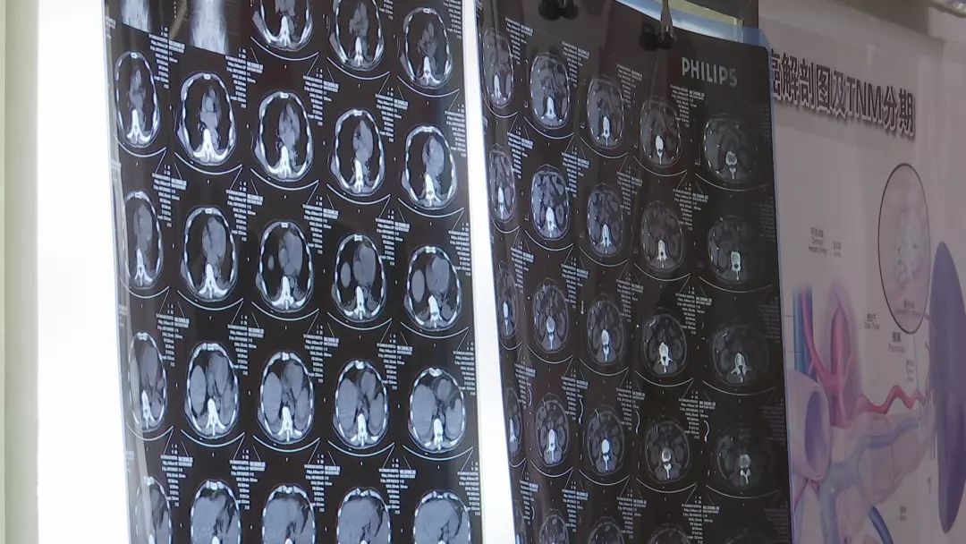 这位96岁的常熟老人多次创下医学奇迹_仲剑平