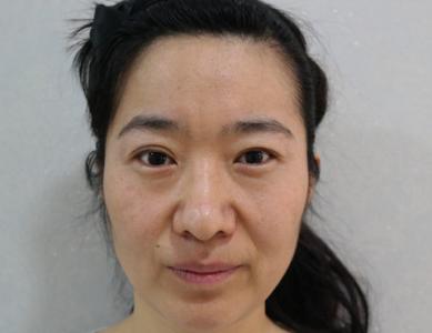 精妆联华化妆品连锁店:脸上皮肤松弛的解决措施你知道哪些?