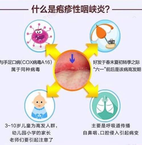 口腔溃疡,鹅口疮,疱疹性咽颊炎这样区分最靠谱