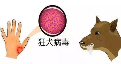 人被动物咬伤后,病兽唾液中的狂犬病毒经破损皮肤侵入体内01狂犬病