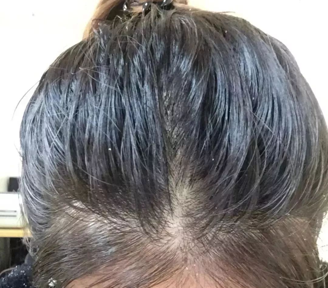 大油头清洁器用它3天不洗头依然干爽不油腻好物上新环聚全球前天