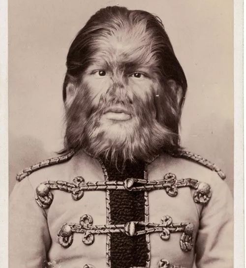 胡辣汤风靡19世纪的畸形秀人性黑暗不外乎如此