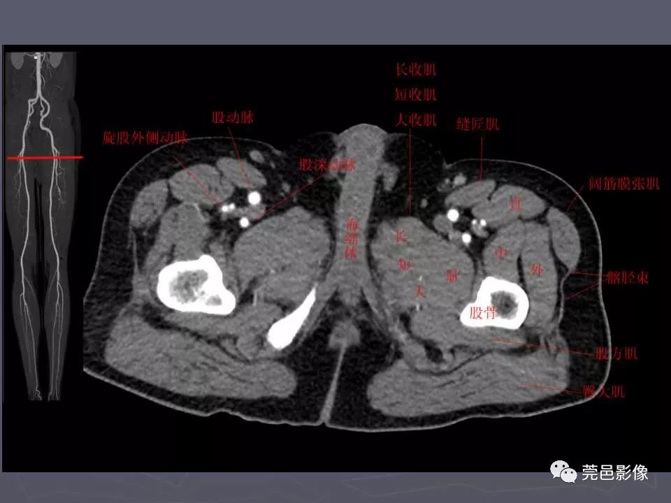 盆腔及下肢影像解剖學