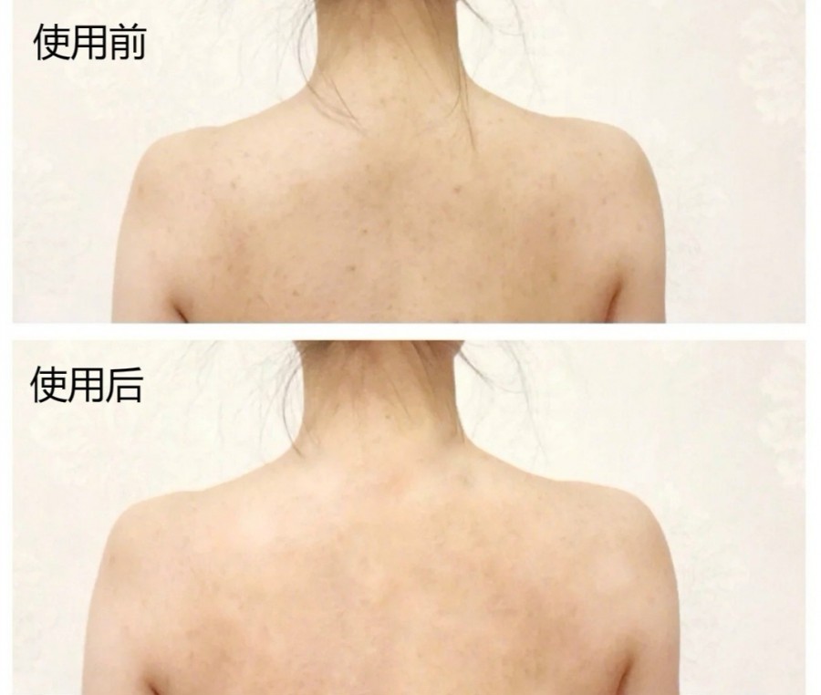 六,gamophen澳洲进口药皂 30r普通的肥皂样子,比舒肤佳肥皂略微小些