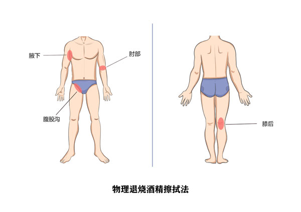 温水擦浴的部位图片