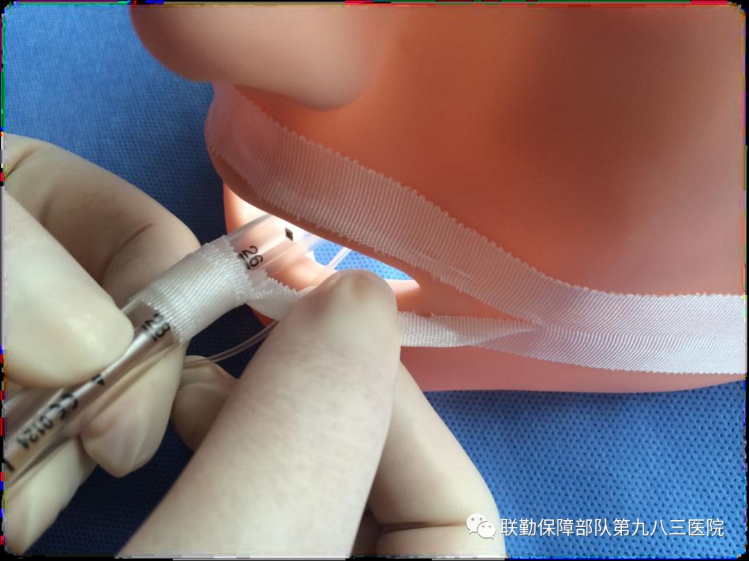 胃管固定贴胶布的剪法图片