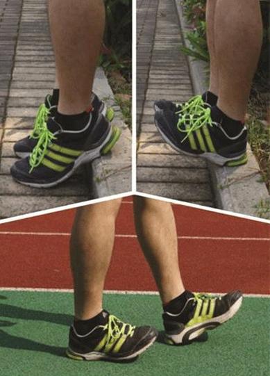 跑步时小腿很疼这个问题处理不好可能越跑越伤