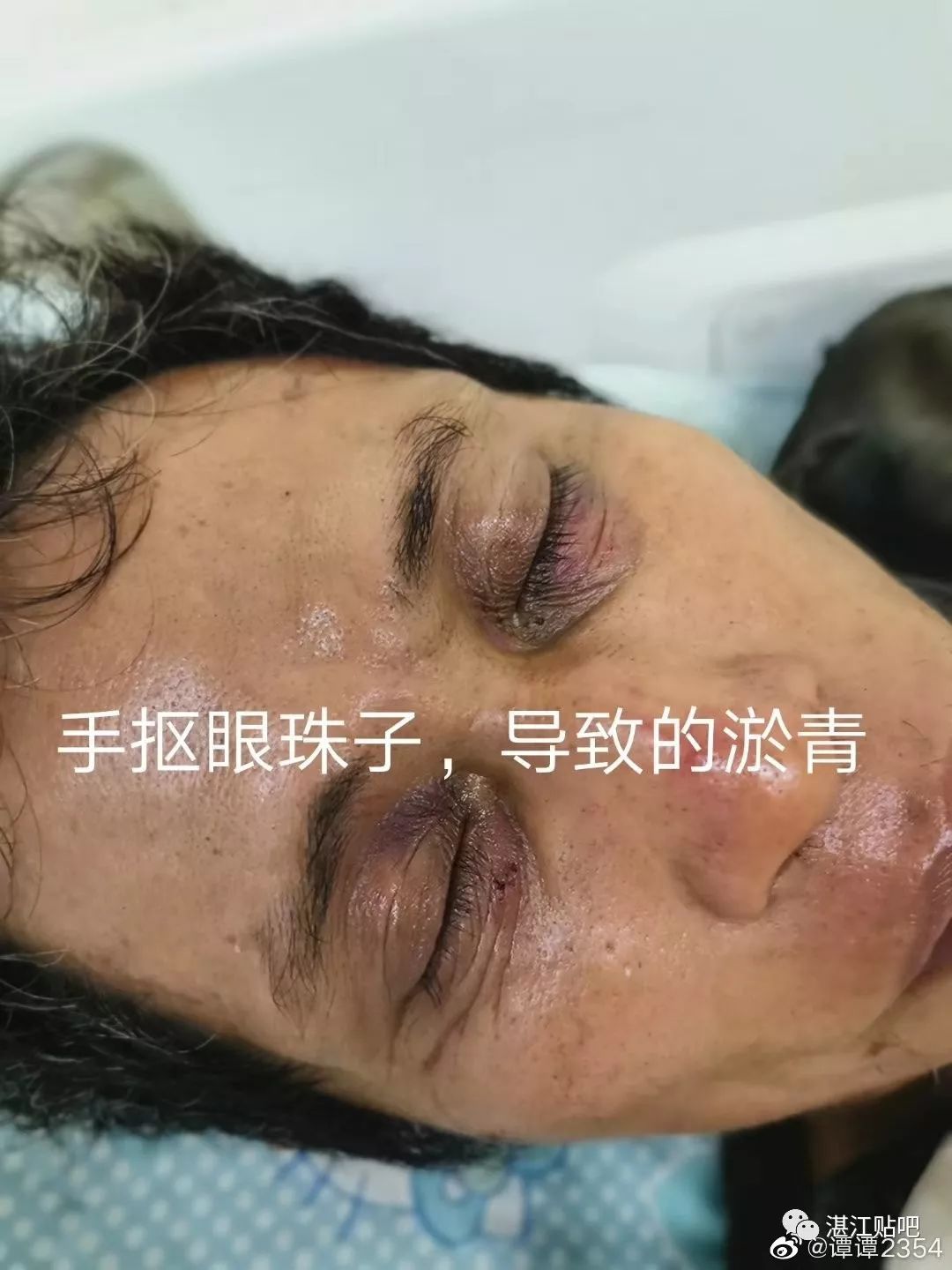 湛江渔船人员被广西籍非法电网捕捞渔船非法囚禁殴打