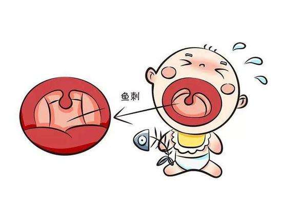 宝宝被鱼刺卡住了怎么破,护理详解!