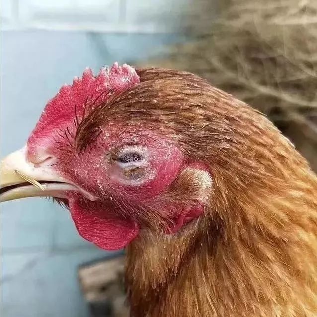 鸡眼睛 常见病图片