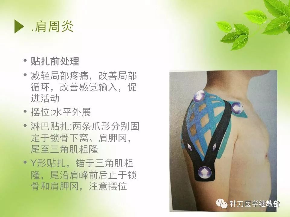 肌内效贴扎技术在康复中的应用