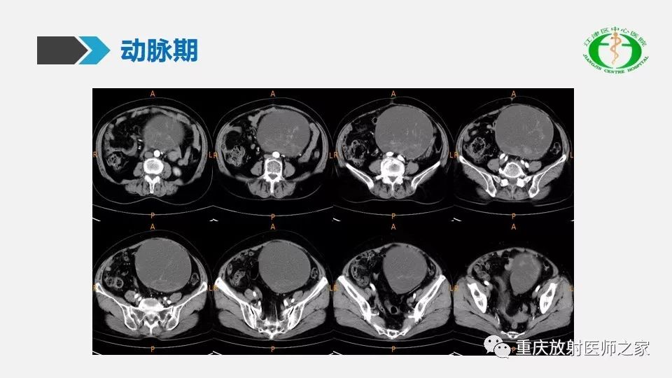 女性ct图片大全图片