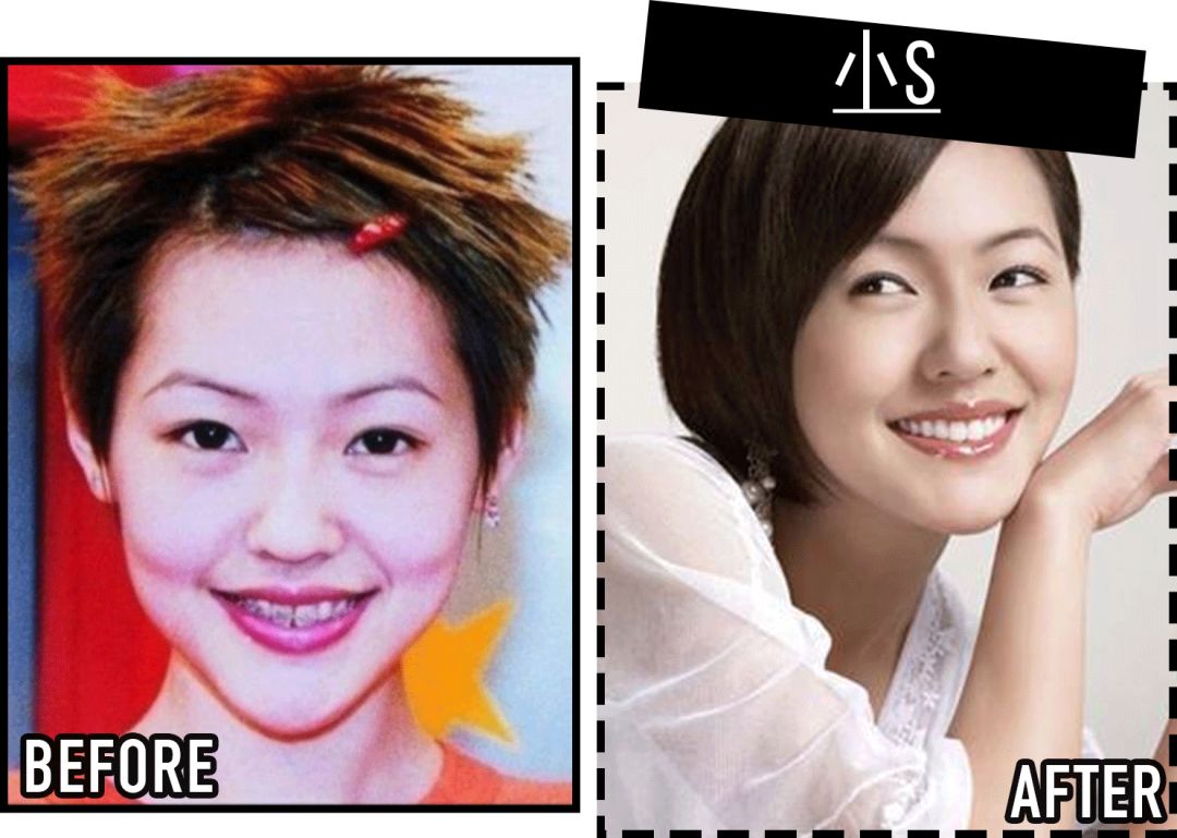 还专门出书记录自己的正畸经过,当时在台湾掀起一阵牙齿矫正热潮95