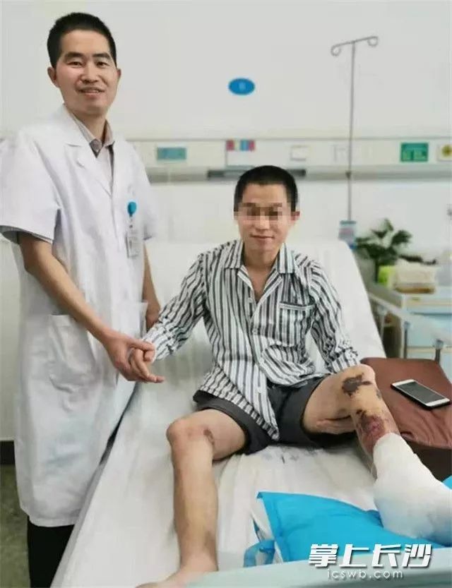 小伙车祸后差点儿截肢医生把他的胳膊寄养在了肚子上